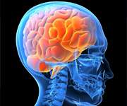 neurology